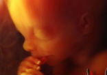 Image of Doctors are prohibited from performing an abortion after the detection of the baby's heartbeat.