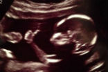 Image of Planned Parenthood was exposed two years ago for selling aborted baby body parts.
